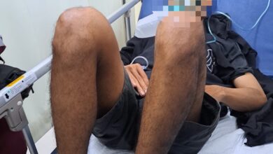 Korban ketika mendapatkan perawatan medis di Rumah Sakit Betang Pambelum