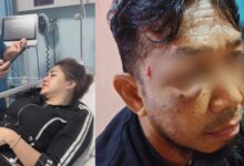 Korban KDRT (kiri) dan korban penganiayaan (kanan)