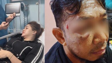 Korban KDRT (kiri) dan korban penganiayaan (kanan)