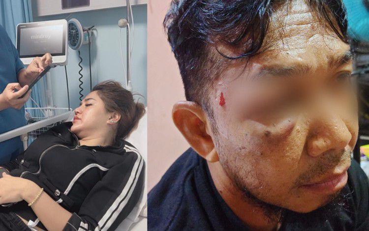 Korban KDRT (kiri) dan korban penganiayaan (kanan)